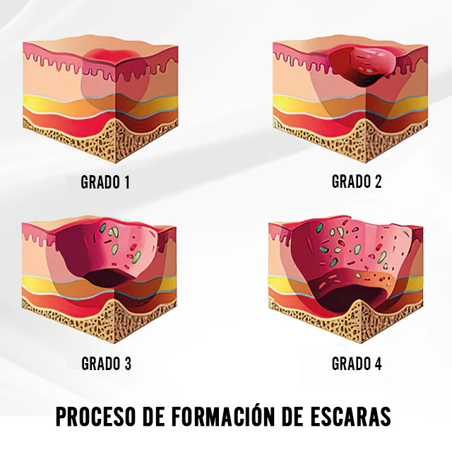 Cojín Antiescaras de Aire con Funda + Pack Completo - Image 8