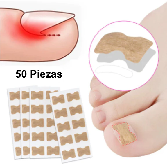 Parches Correctores para Uñas Encarnadas | 50 Piezas - Image 2